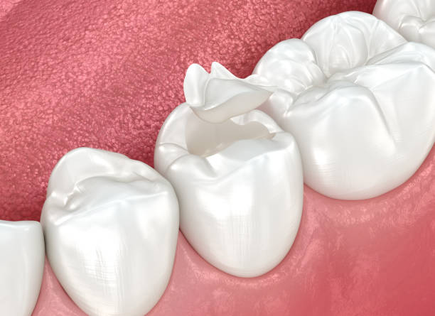 Oral Surgery in Lansing, IL